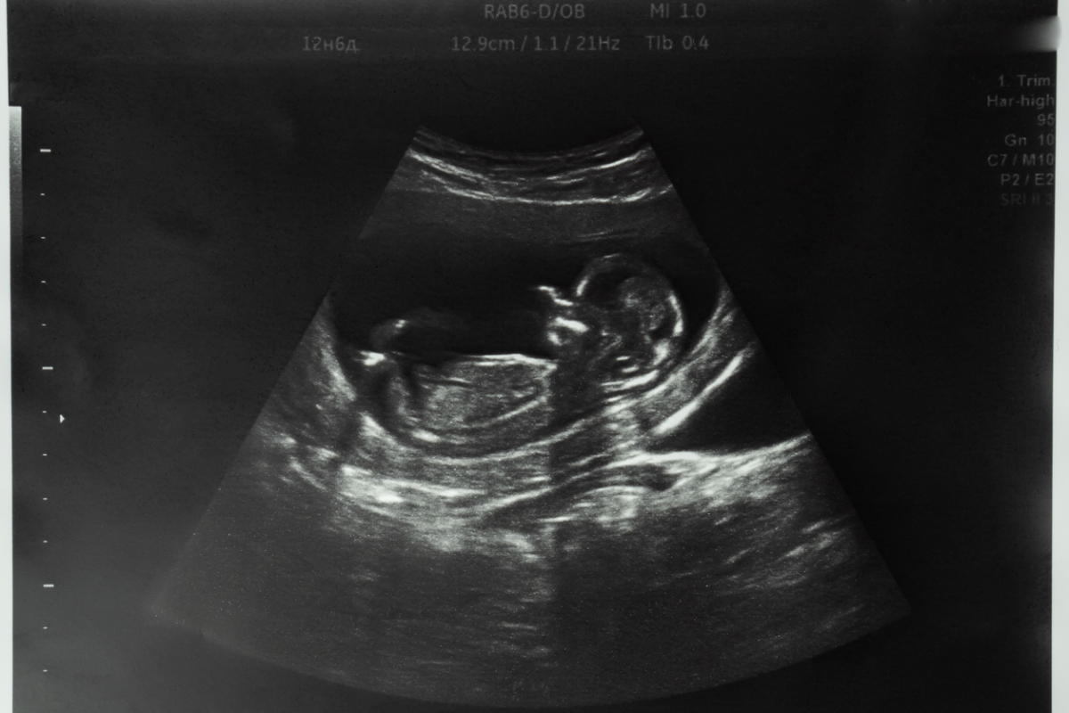 UK abortion figures reach highest level on record as campaigners urge rethink of current law