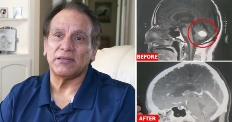 California man's miraculous healing from suspected brain tumor divinely inspired.jpg